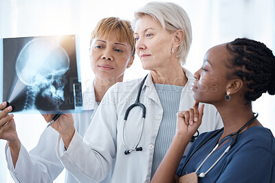 Buy stock photo Xray, women doctors and radiology team planning for test, results charts and healthcare analysis advice. Medical group, neurology and hospital x ray scan of skull, anatomy and review for mri analysis