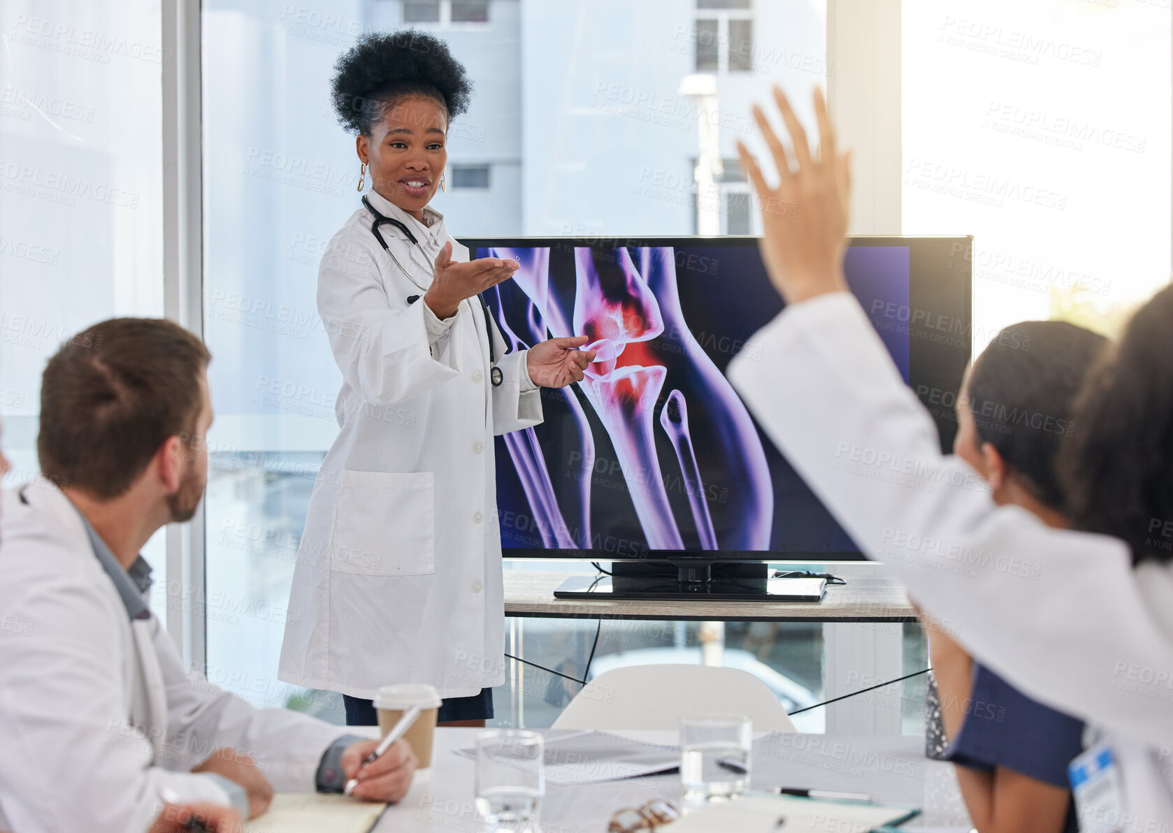 Buy stock photo Medical presentation, woman and doctors xray with hospital team with question. Orthopedic research, happy and collaboration workshop of a health and healthcare group in clinic for diagnosis strategy