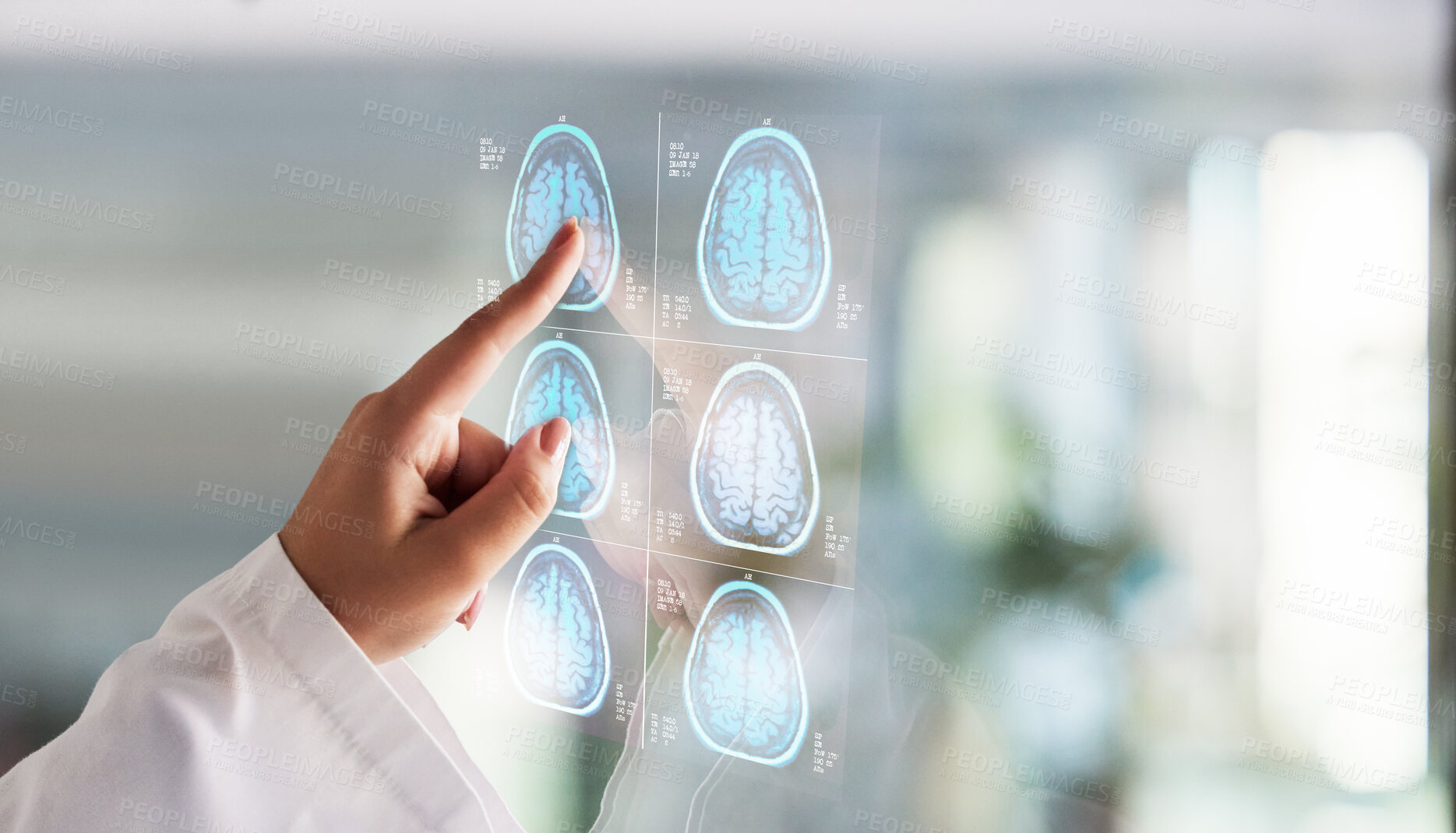 Buy stock photo Brain x ray, digital clinic results and doctor hands with report hologram about neurology work. Anatomy, xray and assessment data with a healthcare 3d info with futuristic mri test in a hospital