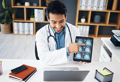 Buy stock photo Video call, laptop and doctor with brain scan on tablet for telehealth, online consulting and patient results. Healthcare, communication and man with digital tech for medical care, service and x ray