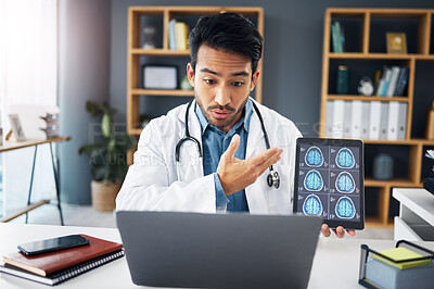 Buy stock photo Mri, man and doctor on video call, talking and healthcare with telehealth, diagnosis and analysis for care. Male employee, medical professional or surgeon with tablet, brain scans or explain solution