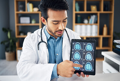 Buy stock photo Brain x ray, video call and doctor with a tablet for advice, healthcare results and showing scan. Education, teaching and an Asian medical worker pointing to radiology research on tech for a webinar