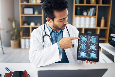 Buy stock photo Neuroscience, man and doctor with scans, explain diagnosis or healthcare in workplace. Male consultant, employee or medical professional with tablet, talking or analysis for solution or brain results