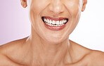Face, smile and dental teeth of woman with veneers, invisalign or tooth whitening in studio isolated on a purple background. Oral health, skincare makeup and lip cosmetics of happy female with beauty