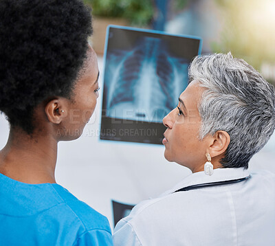 Buy stock photo X ray, senior woman analysis and doctor team with conversation and medical collaboration. Healthcare, clinic and hospital worker with an xray doing problem solving with professional assessment