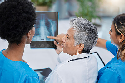 Buy stock photo X ray, mri analysis and doctor team back with conversation and medical collaboration in a hospital. Healthcare, clinic and nurse worker with an xray doing problem solving with professional assessment