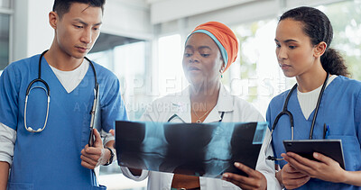 Buy stock photo Doctor, x ray and conversation with a woman surgeon, teamwork and diagnosis in a hospital. Medical, staff and healthcare with professional training, cooperation and interns in a clinic with results