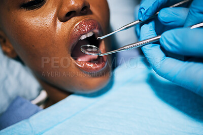 Buy stock photo Mouth, woman and hands of dentist in dental surgery for clean teeth, denchers or oral hygiene at clinic. Female in tooth whitening treatment with tools for cleaning gum bacteria, disease or decay