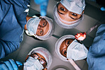 Pov, surgery and doctors with mask, healthcare or treatment for injury, emergency or teamwork. Portrait, medical professional or staff with face cover, support or bottom view of coworkers in hospital