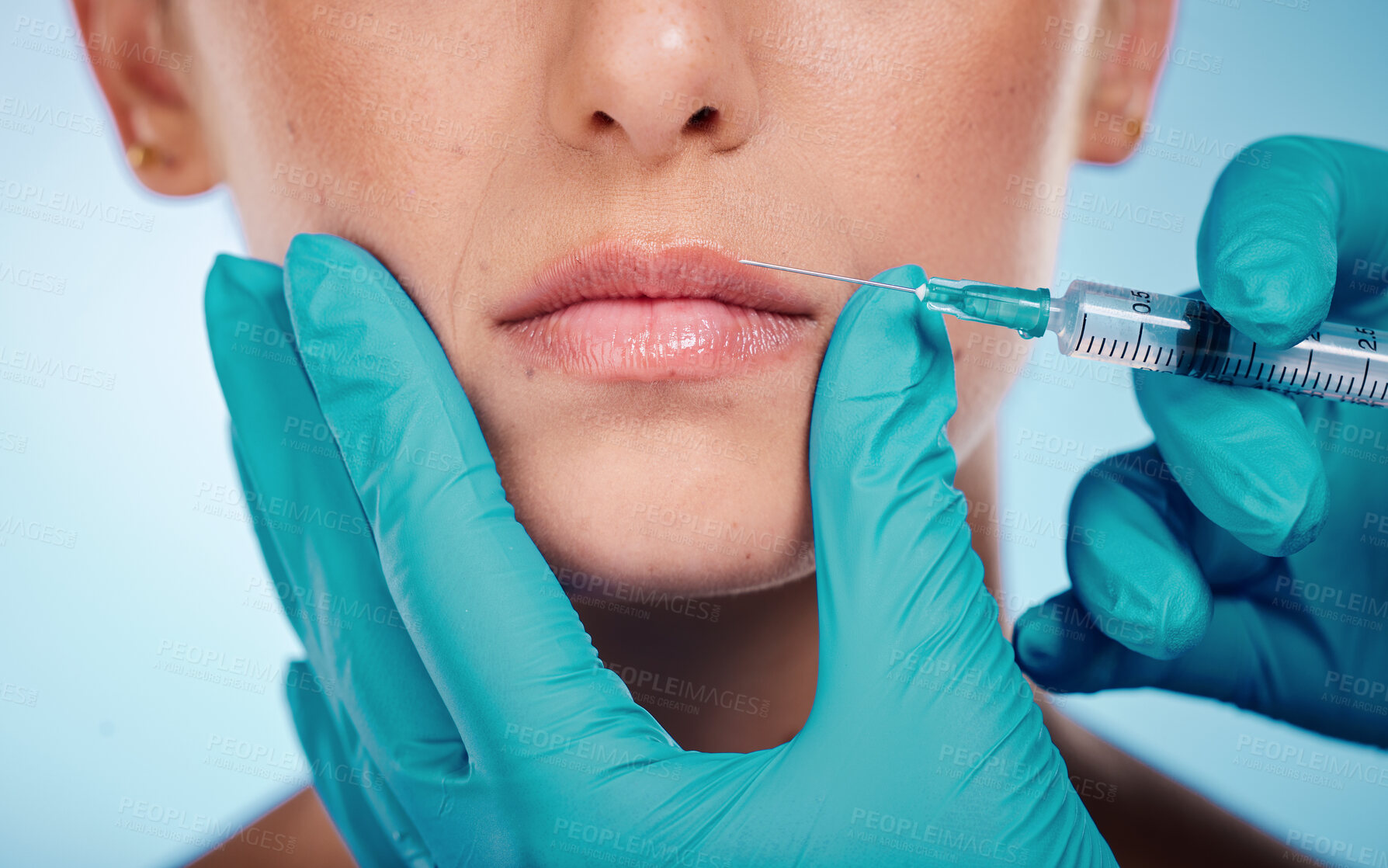 Buy stock photo Fillers, hands and mouth surgery with a woman and doctor in studio on a blue background for face change. Beauty, skin and injection with a surgeon holding a syringe for female client facial filler