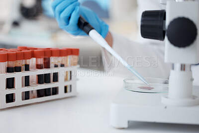 Buy stock photo Hands, pipette and scientist with blood petri dish for research in laboratory. Science, medical professional and doctor with dropper for dna analysis, test and biology experiment to study dna sample.
