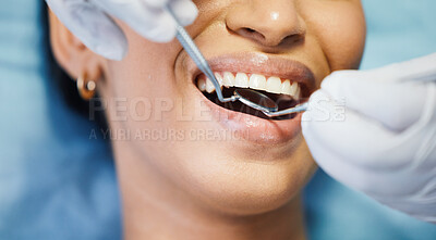 Buy stock photo Dentist, mirror and hands, patient mouth and medical tools, surgery and dental health. Tooth decay, healthcare and people at orthodontics clinic for oral care, metal instrument and gingivitis 