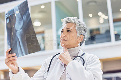 Buy stock photo Woman, radiology doctor and thinking with xray of test results, chart or healthcare analysis idea. Serious female surgeon planning ideas, medical solution and x ray report of bones, anatomy or injury