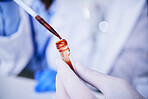 Hands, pipette and scientist with blood test tube for research in laboratory. Science, medical professional and doctor with dropper for dna analysis, liquid and biology experiment to study dna sample