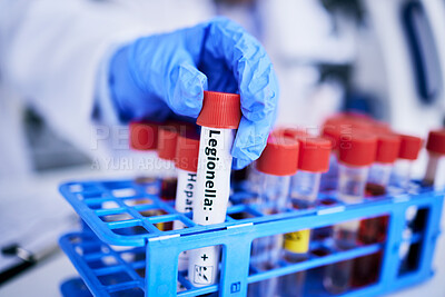 Buy stock photo Scientist, hand and bacteria sample in test tube, person in lab with medical research and healthcare study. Doctor, gloves and vaccine, check legionella sample closeup and scientific experiment