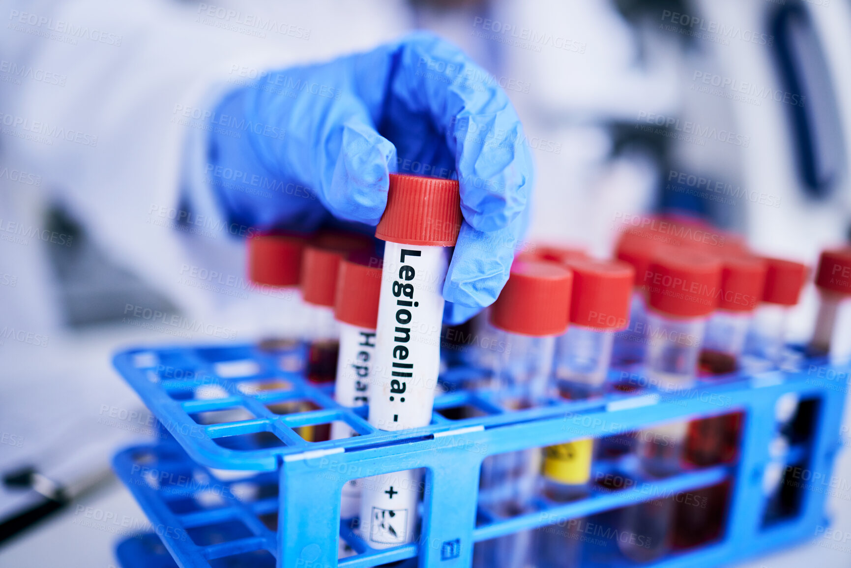 Buy stock photo Scientist, hand and bacteria sample in test tube, person in lab with medical research and healthcare study. Doctor, gloves and vaccine, check legionella sample closeup and scientific experiment