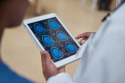 Buy stock photo Doctor, hands and tablet with brain scan in healthcare examination, surgery or anatomy research at hospital. Hand of male person or medical professional with technology of head x ray exam at clinic