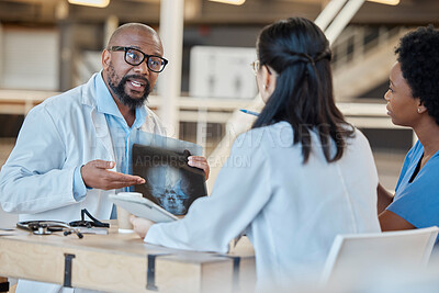 Buy stock photo Black man, doctors and meeting with xray in clinic for test results, research or healthcare review. Medical team, manager and group planning radiology assessment, x ray report and staff collaboration