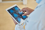 Brain scan, xray and closeup of a doctor with a tablet for a neurology consultation or surgery. Healthcare, digital technology and hands of surgeon analyzing a mri image in medical hospital or clinic