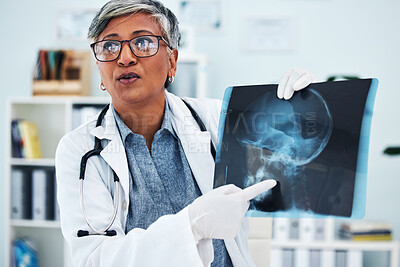 Buy stock photo Hospital, doctor and senior woman with x ray for surgery, medical consultation and in diagnosis with patient. Healthcare, medicare and female health worker explain with head scan for injury analysis