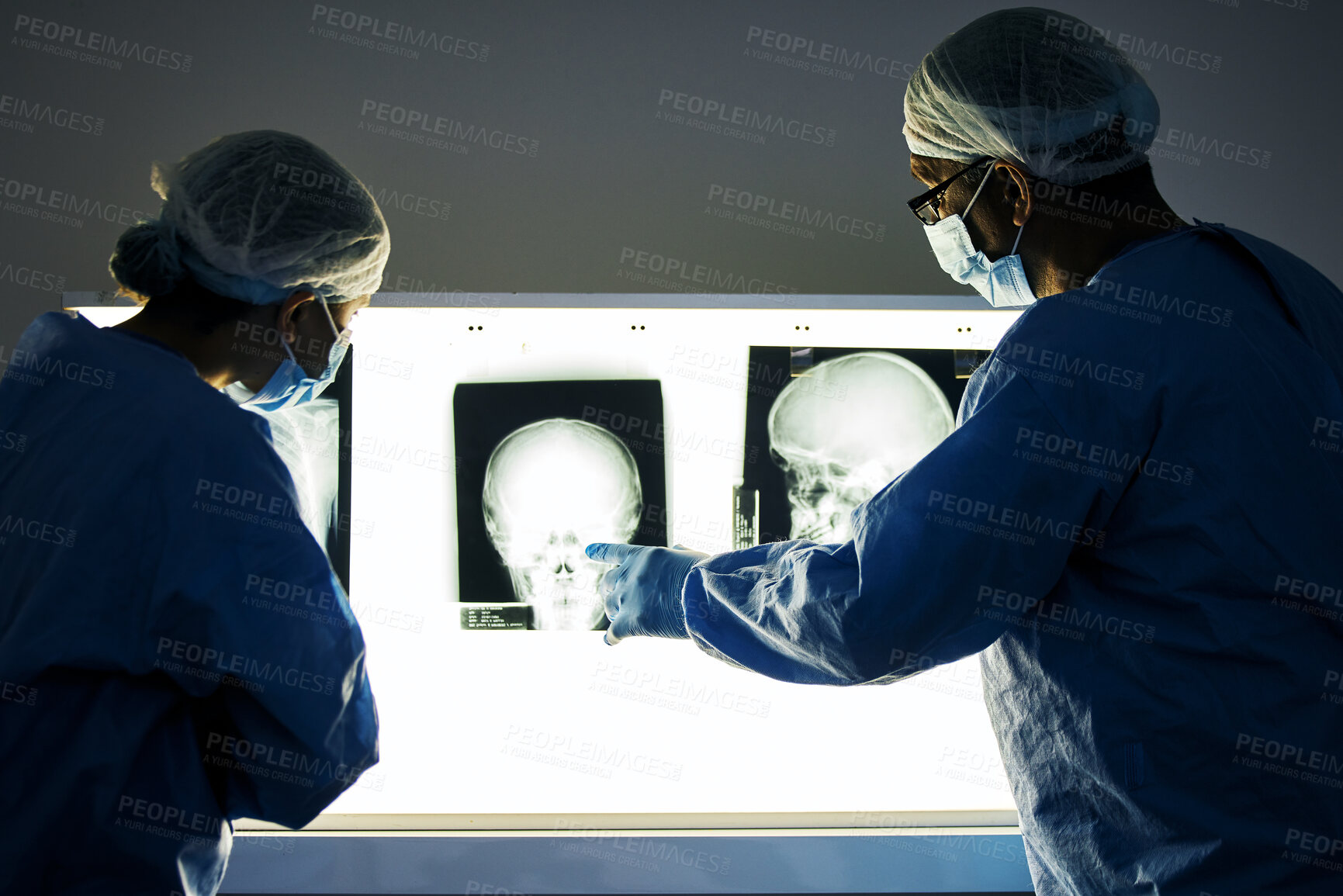 Buy stock photo Dentist team, teeth x ray and together for analysis, study and learning in clinic for healthcare. Surgeon group, monitor skull and tooth growth for wellness, care or point with discussion in hospital