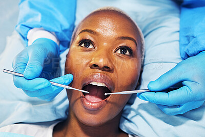 Buy stock photo Dental surgeon, woman and tools in mouth at clinic for cavity, teeth whitening and helping hand for pain. Dentist, African patient and top view for tooth extraction, care and check for healthy smile