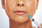 Lips, injection and face of woman for plastic surgery in studio, white background and skincare. Closeup of female model, cosmetics and syringe on mouth for dermatology, facelift and filler for beauty