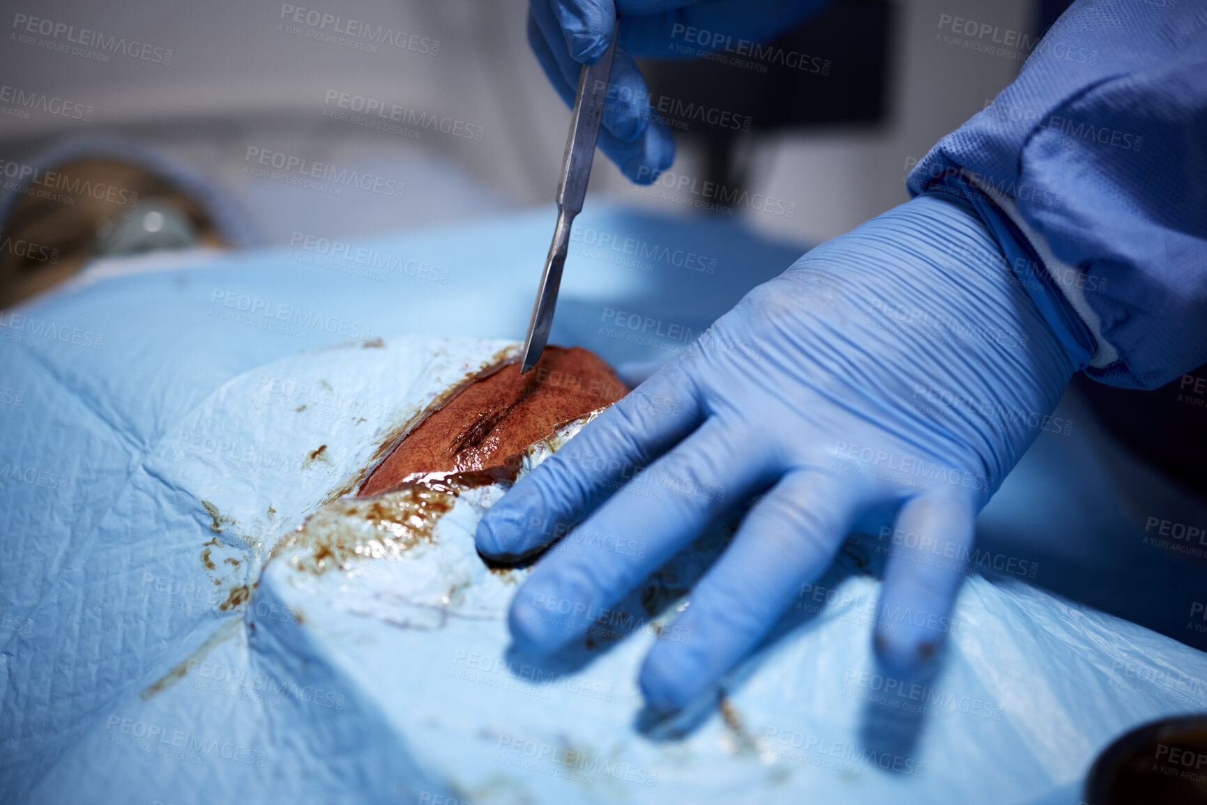 Buy stock photo Blood, hands or doctors cutting in surgery or emergency procedure or healthcare operation in hospital. Knife, medical safety tools or closeup of surgeon in gloves helping in operating room in clinic