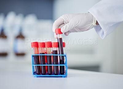Buy stock photo Hand, doctor and blood in test tube, health and sample for experiment with medical research in lab. Scientist, person and healthcare, check for virus or bacteria with scientific study and pathology