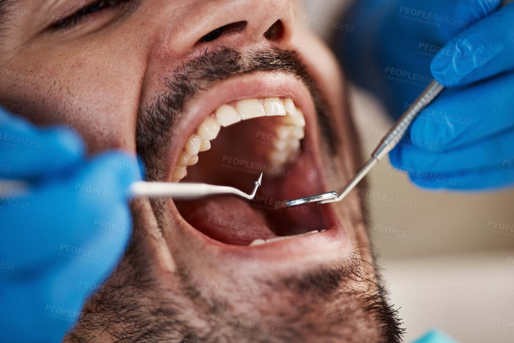 Buy stock photo Mouth, man and hands of dentist with tools for dental, healthcare or check in clinic. Oral wellness, orthodontics and patient with doctor, mirror and excavator for teeth cleaning and medical hygiene