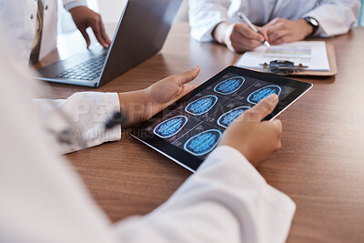 Buy stock photo Doctor, tablet screen and hands of person with brain scan MRI, cancer tumor results and consulting on digital xray data. Closeup teamwork, radiology and neurosurgeon collaboration on anatomy exam