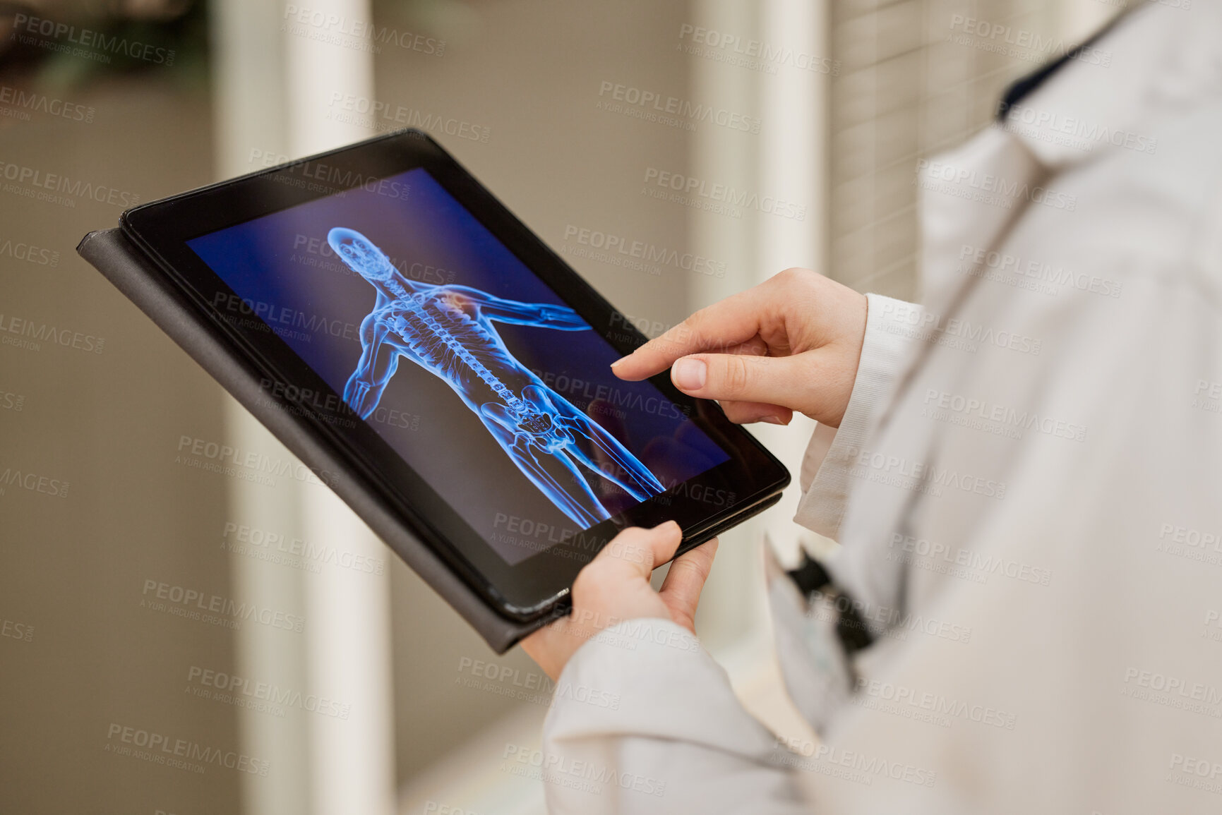 Buy stock photo Doctor, hands and tablet x ray, mri results and healthcare research, anatomy solution and injury review of skeleton. Medical professional or radiology person with xray graphic on digital screen