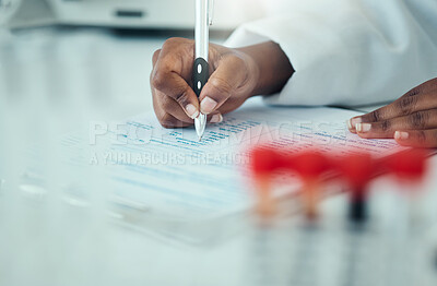 Buy stock photo Results, hands or woman scientist writing research notes for analysis on experiment or medical paperwork. Notebook, closeup or expert in a laboratory with documents info for science development