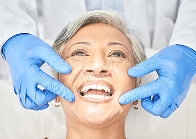 Senior woman, mouth and dentist hands with dental procedure, medical and healthcare with closeup. Oral health, orthodontics and patient with doctor, teeth whitening and veneers with assessment