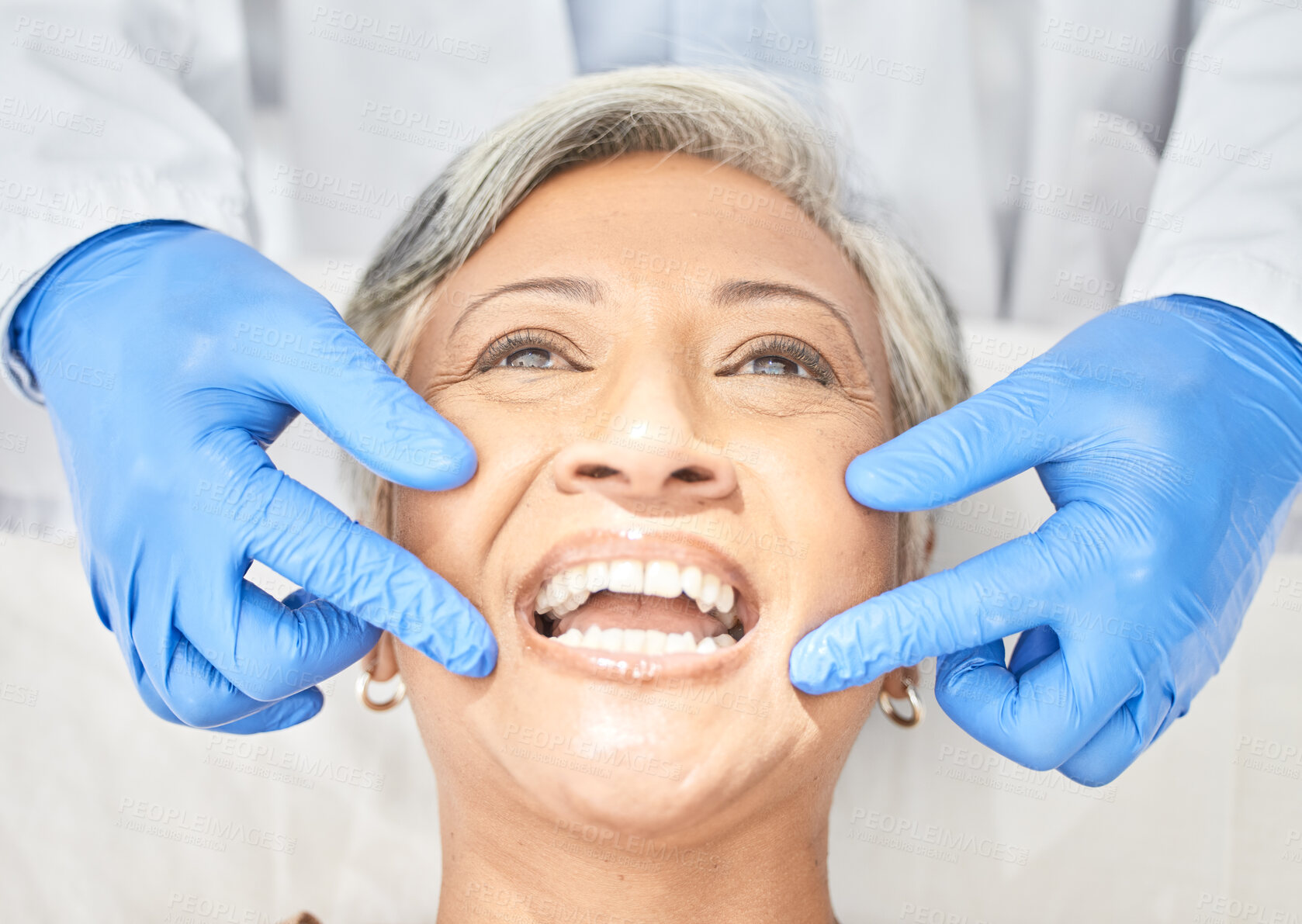 Buy stock photo Senior woman, mouth and dentist hands with dental procedure, medical and healthcare with closeup. Oral health, orthodontics and patient with doctor, teeth whitening and veneers with assessment 