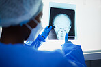 Head xray, medical doctor and surgery charts, test results and healthcare analysis from the back. Radiology, neurology and surgeon check skull x ray, anatomy and review mri for hospital operation  