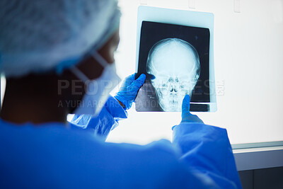 Buy stock photo Brain xray, medical doctor and surgery charts, test results and healthcare analysis of the head. Radiology, neurology and surgeon check skull x ray, anatomy and review mri for hospital operation  