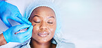 Plastic surgery, pen and black woman sleep on a hospital bed with dermatology with mockup space. Surgeon, facial change and medical filler for skincare, cosmetics and wellness in a clinic with doctor