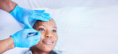 Buy stock photo Plastic surgery, needle and black woman on a hospital bed with dermatology with mockup space. Surgeon, facial change and medical filler for skincare, cosmetics and wellness in a clinic with doctor