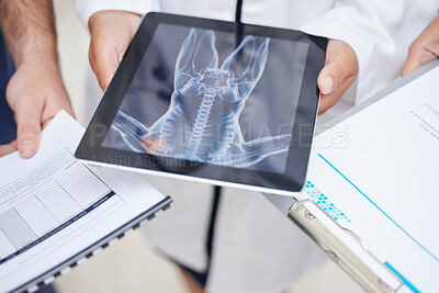 Buy stock photo Doctor, hands and tablet with x ray in anatomy, surgery or results in MRI, CT or body scan at hospital. Closeup of medical professional team with technology or documents in patient analysis at clinic