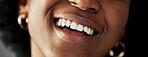 Dental, beauty and teeth with closeup of person for medical, cosmetics and oral hygiene. Health, orthodontics and smile with mouth of black woman for self care, gum and whitening treatment on banner
