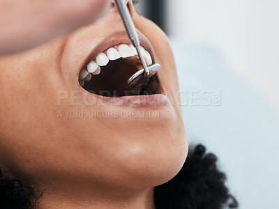 Buy stock photo Mouth, teeth of woman and dentist with tools for dental cosmetics, healthcare assessment and test in clinic. Oral service, orthodontics and closeup of patient, mirror and excavator for tooth cleaning