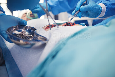 Buy stock photo Surgery, team hands and patient operation, hospital emergency or group of doctors help, support or healing wound. Accident injury blood, medical tools and healthcare surgeon teamwork on saving person