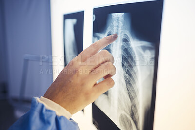 Buy stock photo Medical, hand and doctor analyzing xray for healthcare diagnosis on a screen in hospital. Professional, career and closeup of woman radiologist checking spine, lung and chest scan in medicare clinic.