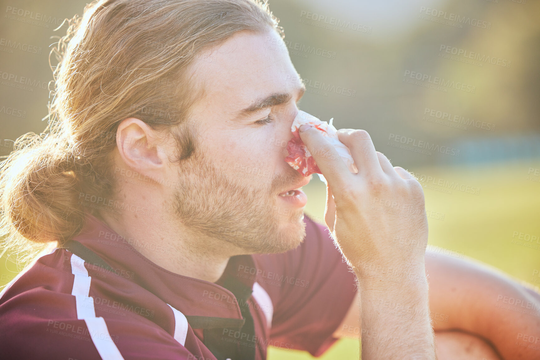 Buy stock photo Nose bleed, man closeup and sports injury closeup on field with emergency, health accident and blood outdoor. Swollen, broken and male athlete with medical and pain or bruise after game and exercise