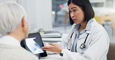 Tablet, xray and patient in consultation with doctor, medical results and analysis, advice on health diagnosis. Chest, anatomy and radiology, communication and women in office, surgery and healthcare