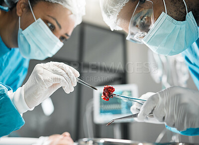 Buy stock photo Healthcare, tools and doctors in surgery with anatomy, equipment and teamwork support in hospital. Nurse helping medical surgeon, medicine and safety for patient in bed for emergency operation in ER.