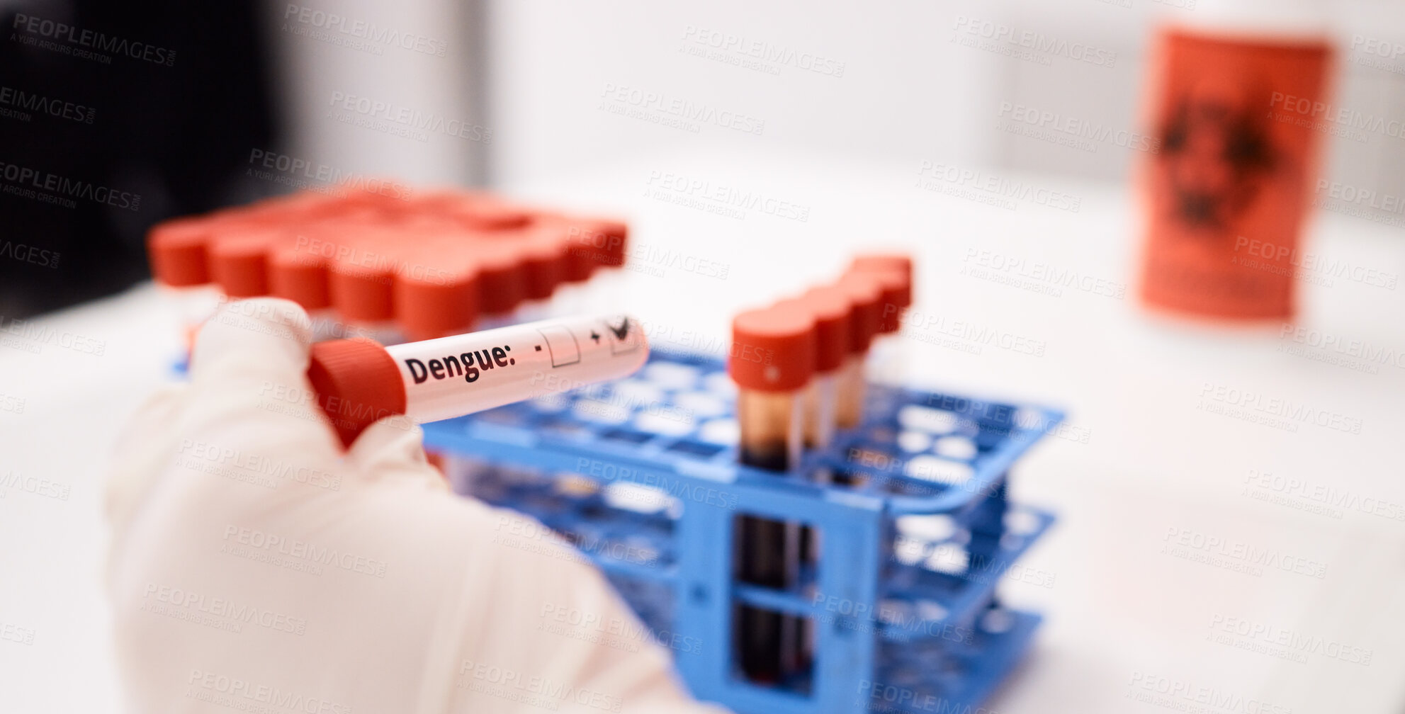 Buy stock photo Blood, dengue or hands of scientist in lab with virus and science for innovation, dna and rna research. Zoom, analysis closeup or person working with liquid for chemistry, test or breakthrough cure