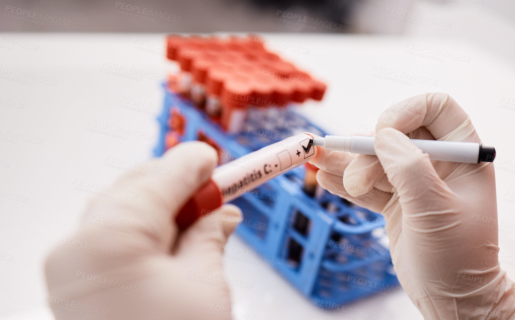 Buy stock photo Label, scientist or hands writing on blood test tube, DNA or science experiment in laboratory. Closeup, hepatitis or person with study sample or research for biology innovation or medical results