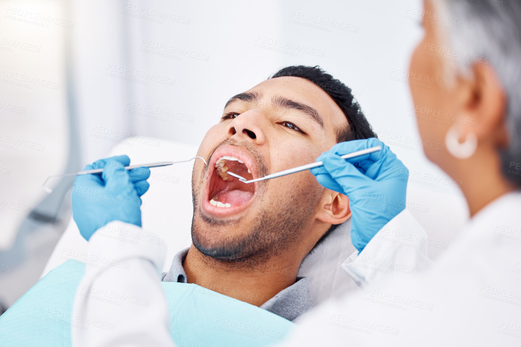 Buy stock photo Dentist, patient man and consultation for mouth and teeth whitening, cleaning or veneers hygiene. Oral health, orthodontics and a person for tooth care, dental assessment and mirror tools at clinic